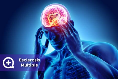 Esclerosis Múltiple: diagnóstico, síntomas y tratamiento - mediQuo