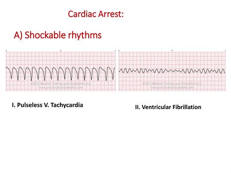 ACLs review.ppt