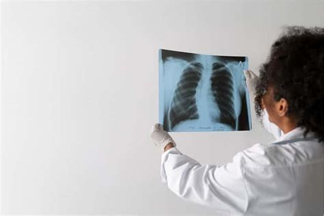 Lung Cancer: Causes, Symptoms, Treatment & Prevention