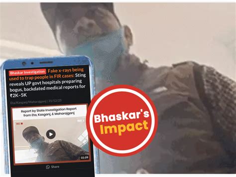 UP govt suspends 2 hospital staff for fake X-ray reports: 1 dismissed ...