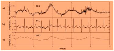 Wearable IoT Smart-Log Patch: An Edge Computing-Based Bayesian Deep ...