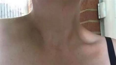 Self-Strangulation Risks 的图像结果