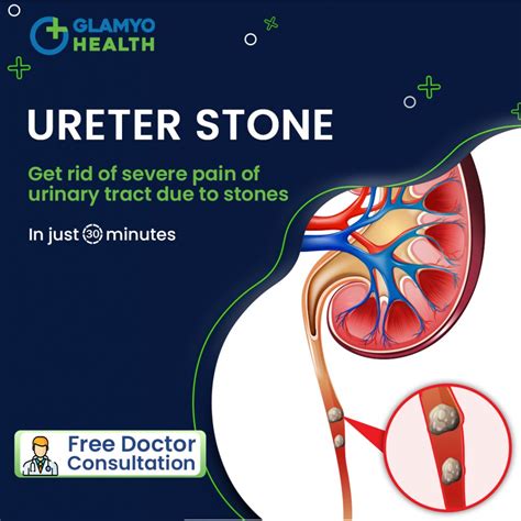 Why Does Heat Help Kidney Stones at Christy Calvin blog