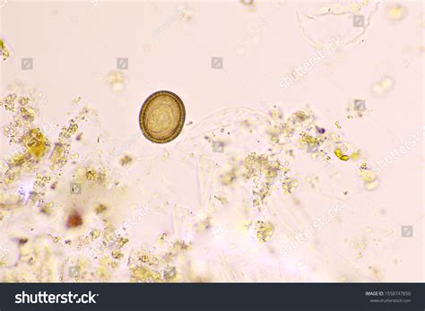 649 Taenia Egg Images, Stock Photos & Vectors | Shutterstock