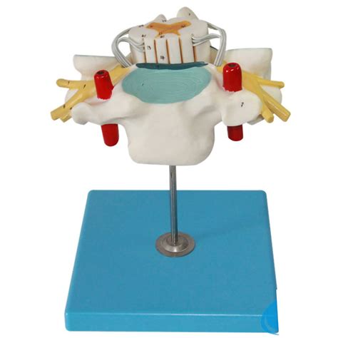 Buy PVC Human Anatomy Magnifies Cervical Spinal Cord and Spinal Nerve ...