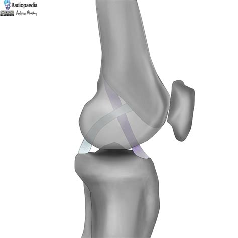 Radiopaedia - Drawing Anterior and posterior cruciate ligaments of knee - no labels | AnatomyTOOL