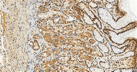 NRF1/nuclear respiratory factor 1 antibody (12482-1-AP) | Proteintech