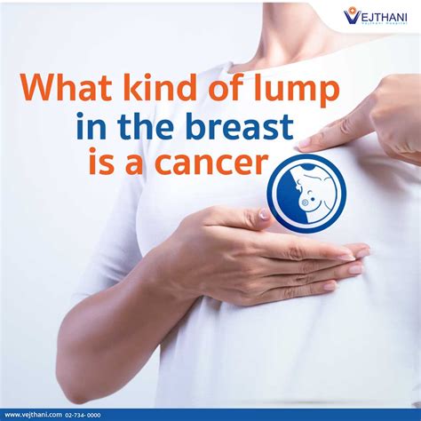 What Does Lump On Chest Mean at Michelle Harper blog