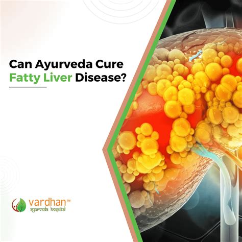 Can Ayurveda Cure Fatty Liver Disease? - Vardhan Ayurveda