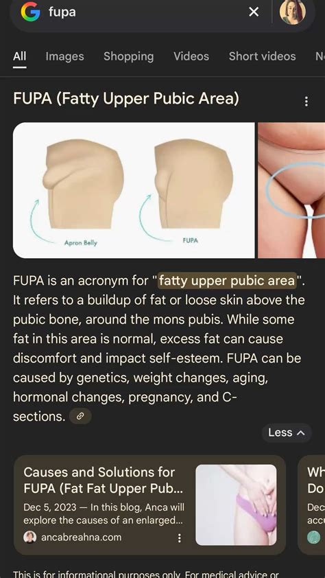 Pin by Vijay D on APPLE in 2025 | Basic anatomy and physiology, Body ...