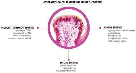 Pigmented Fungiform Papillae (PFP) of the Tongue: A Systematic Review ...