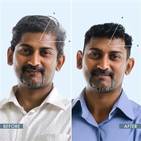 Anti Grey Hair Prime Serum | Men Women: Reverse Premature Greying