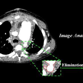CT Scan 的图像结果