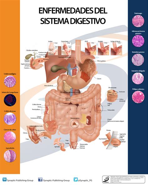 Enfermedades Del Aparato Digestivo