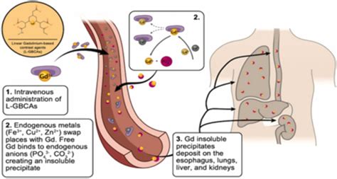 Gadolinium contrast agents- challenges and opportunities of a multidisciplinary approach ...