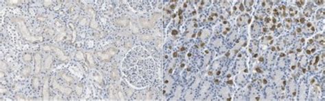 Anti-sodium/hydrogen exchanger 3 Antibody, clone 3H3 clone 3H3, from ...