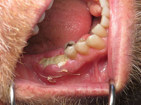 Is It Normal? Extraction Bone Graft White Membrane Showing | Ramsey Amin, DDS