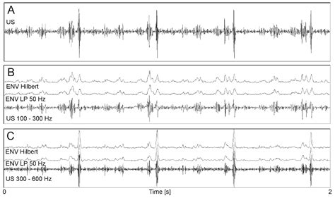 New Method for Beat-to-Beat Fetal Heart Rate Measurement Using Doppler ...
