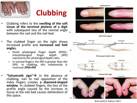History Taking and Physical Examination of Cardiovascular System-The ...