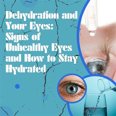 Dehydration and Your Eyes: Signs of Unhealthy Eyes and How to Stay Hydrated