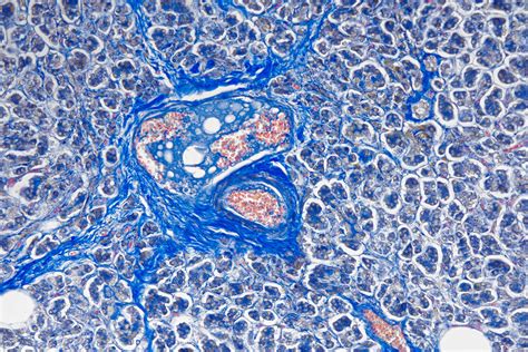 Image result for Digital Microscope Lens