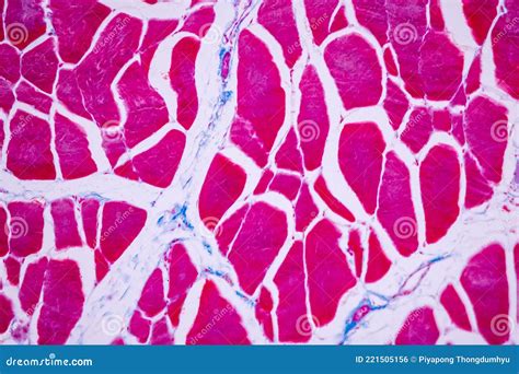 Image result for Skeletal Muscle Tissue Under Microscope