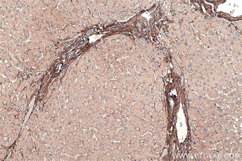 IHCeasy BGN/Biglycan Ready-To-Use IHC Kit KHC0480 | Proteintech