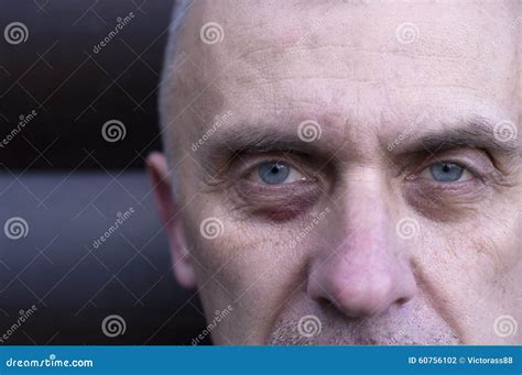 Man with Bruise stock photo. Image of stare, horizontal - 60756102