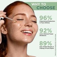 5% Niacinamide Acne Face Serum | Best Anti Acne Serum – Orgatre