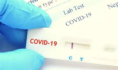 RT-PCR bests rapid tests for diagnosing high risk COVID-19 patients ...