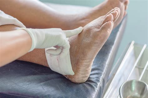 How Top Experts Are Advancing Gout Care in the United States - Medical Bag
