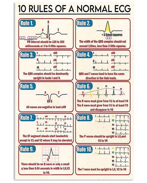 Normal ECG Read Out 的图像结果