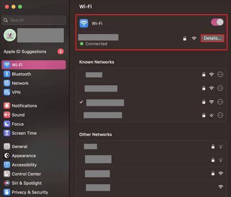 Image result for How to Use Static IP