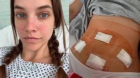 'Sleepless Nights On Bathroom Floor': Barbara Palvin On Undergoing ...