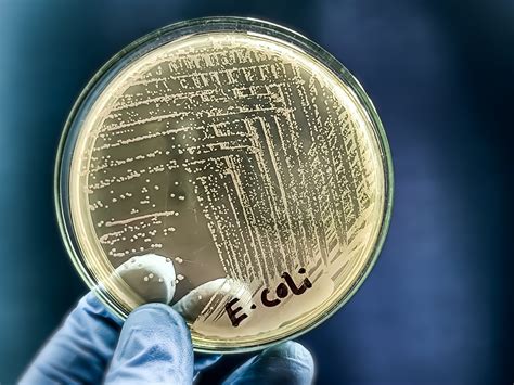 E. coli - Health Beat