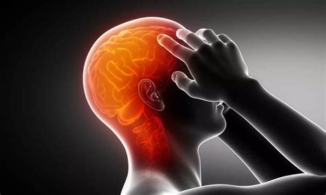 Certain migraine medications more effective than ibuprofen for treating ...