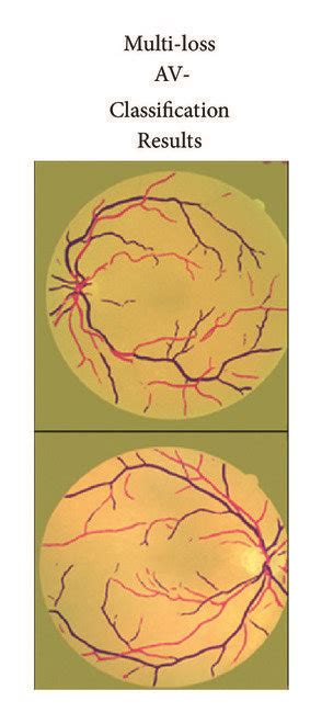 Image result for Channel AV Classification