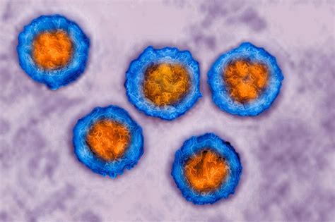 Chickenpox Outbreak at School Linked to Vaccine Exemptions - The New ...