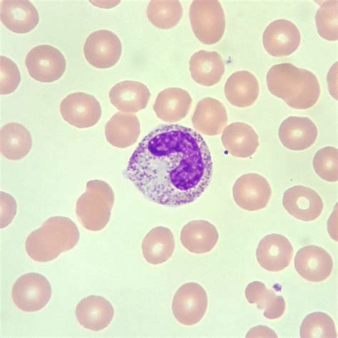 Band Neutrophils: Identification & Differentiation
