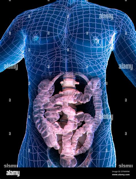 CT Scan 的图像结果