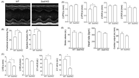 Myocardial Hypertrophy and Compensatory Increase in Systolic Function ...