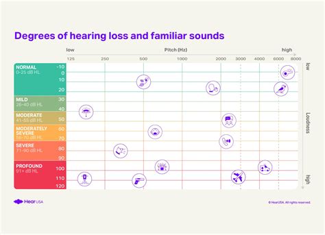 How to Read Audiogram Symbols? Examples, Legends & More