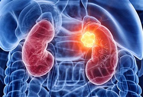Dr. Vikas Bharati Best Nephrologist In Panvel, Mumbai