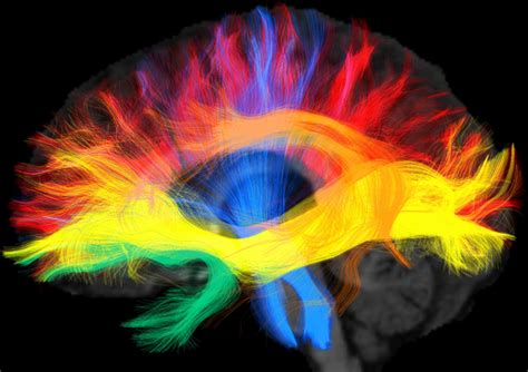 Language Brain 的图像结果