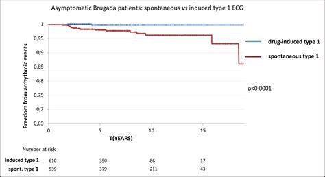 Asymptomatic Patients With Brugada ECG Pattern: Long-Term Prognosis From a Large Prospective ...