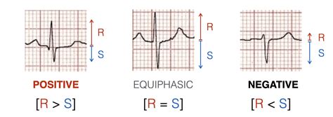 Negative site:https://www.facebook.com/ 的图像结果