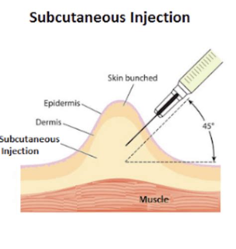 Image result for Subcutaneous Button Device