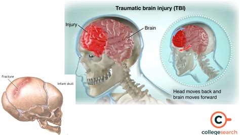 Saddle Joint: Definitions, Examples, Origin, Features, Movement ...