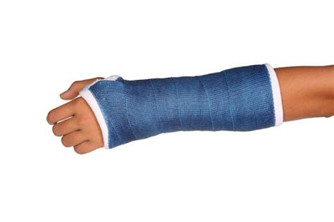 Cast Braces For Fractures – Fast, Comfortable Recovery