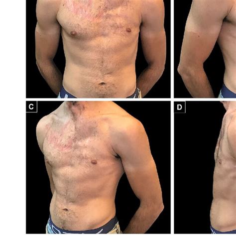 Image result for Contralateral Oblique View